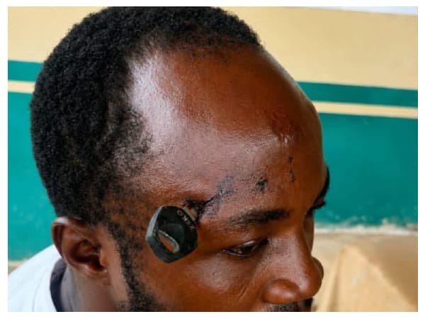 Man hospitalised after allegedly being stabbed in skull