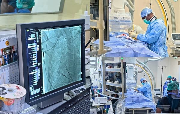 Four patients receive treatment at new Cath Lab at Korle Bu - Felix Kwakye Ofosu