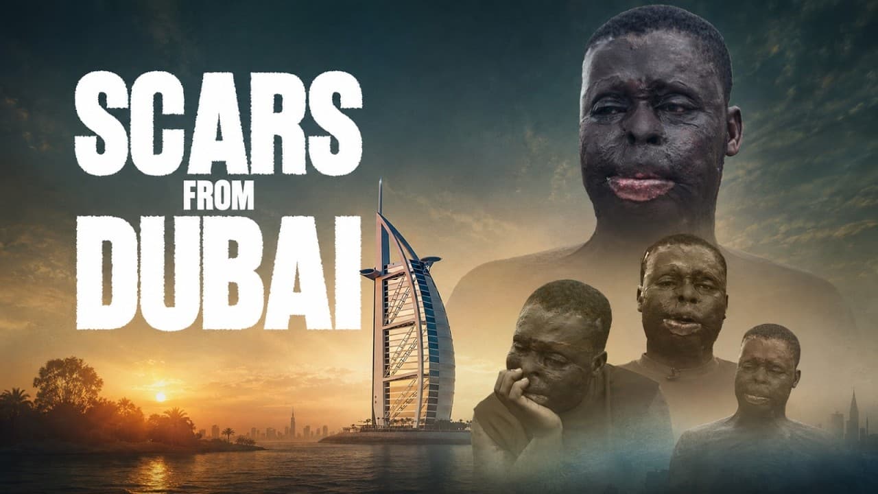 Scars From Dubai: 28-year-old fights to rebuild his life after acid attack disfigured him