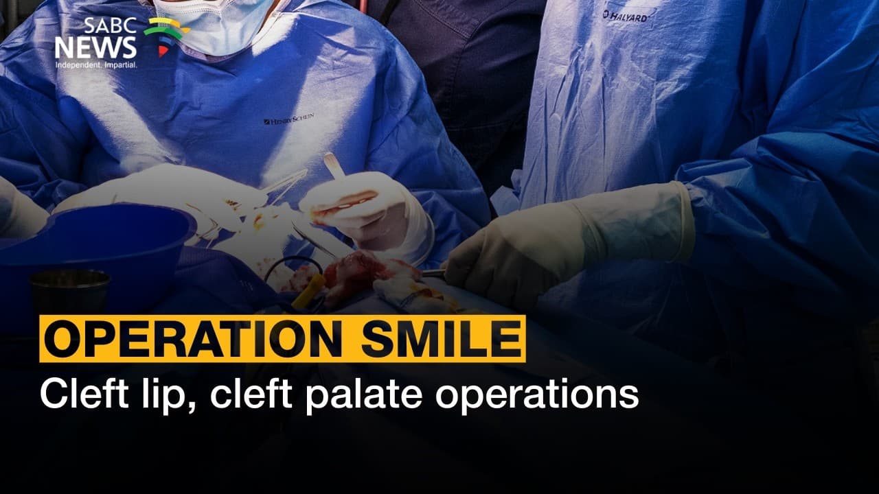 Free cleft lip surgeries under way at Rob Ferreira Hospital