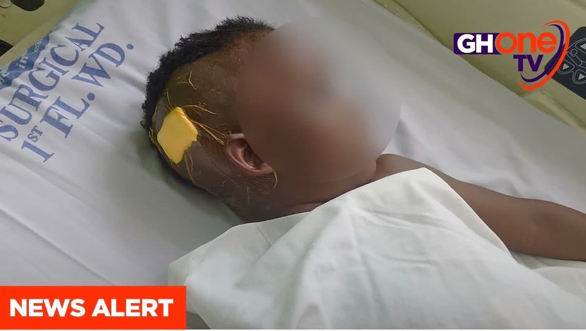 Anonymous donor pays GH¢80,000 for 5-year-old Joycelyn Amoako’s brain tumor surgery