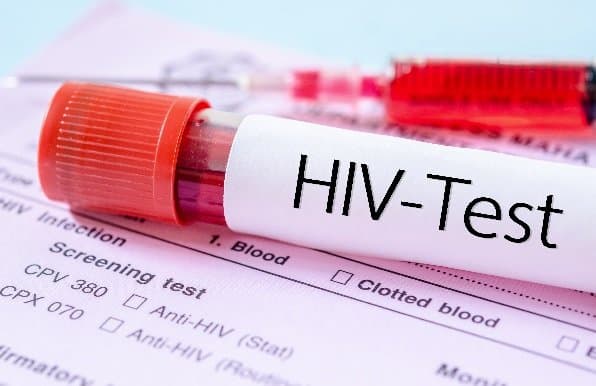 GHANET launches online HIV self-test platform to boost testing amid diagnosis gaps