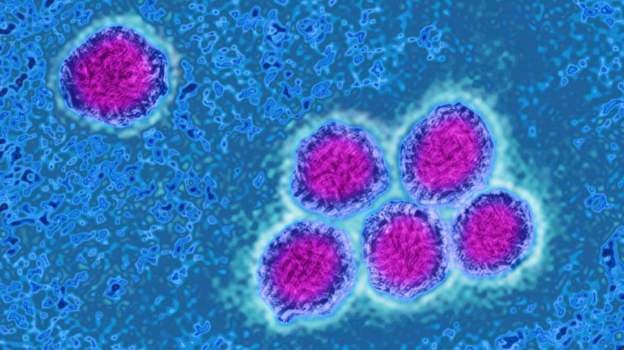 Yellow Fever deaths in Sissala East worrying – MP