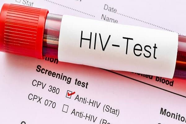 Sekondi-Takoradi records 152 new HIV infections in 2025