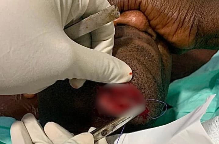 Kenpong suffers serious injuries after freak domestic accident
