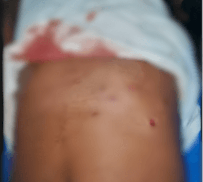 Two injured as armed robbers attack mobile money vendors in Central Region