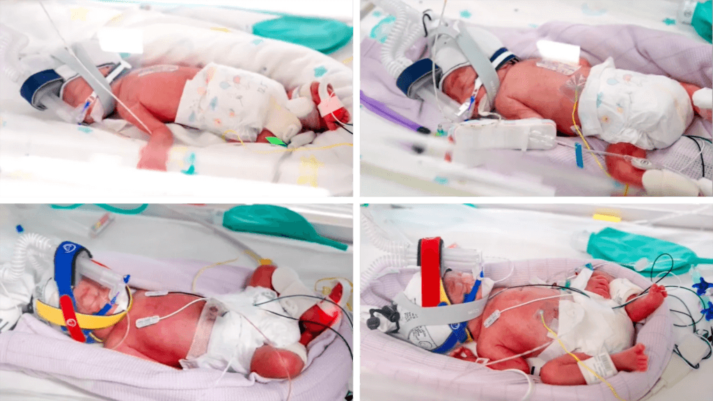 Rare identical quadruplets born in Australia