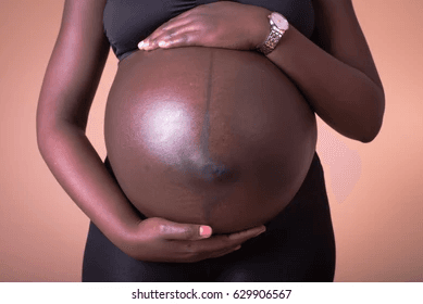 When the Belly Begins to Speak: The Beautiful Mystery of Pregnancy’s Dark Mark