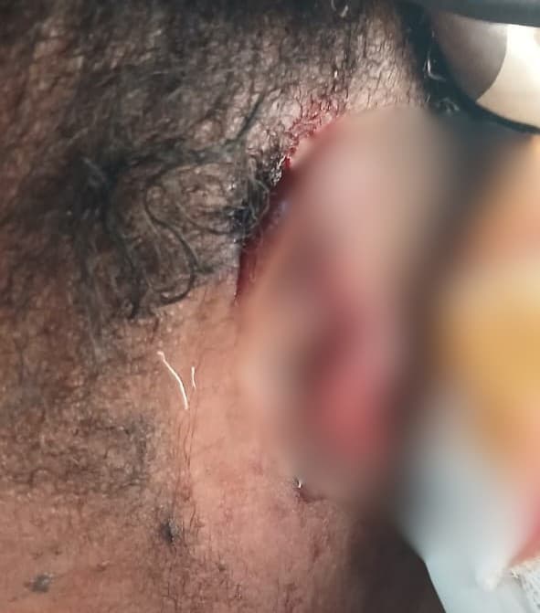 Police arrest landlord’s wife for allegedly biting tenant’s ear during a fight