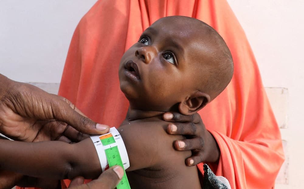 Somalia malnutrition response hit by funding cuts: MSF