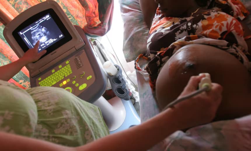 The Trump administration said it would prioritize ending mother-to-child HIV transmission. Health workers say it cut services