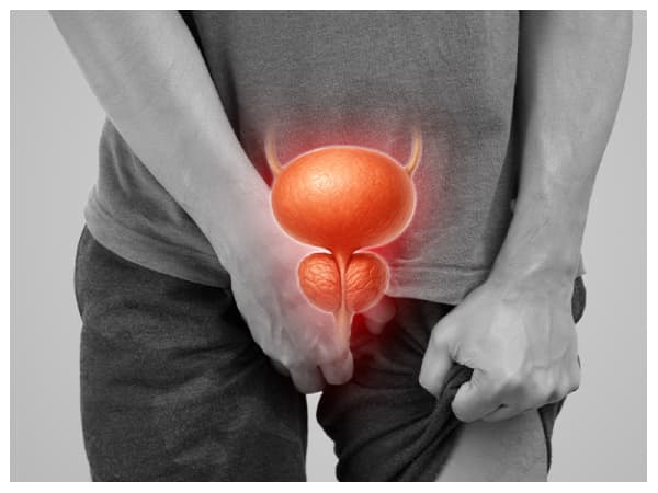Prostate Cancer: What Ghanaian men need to know