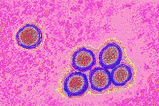 Yellow Fever outbreak kills 7 in Sissala East