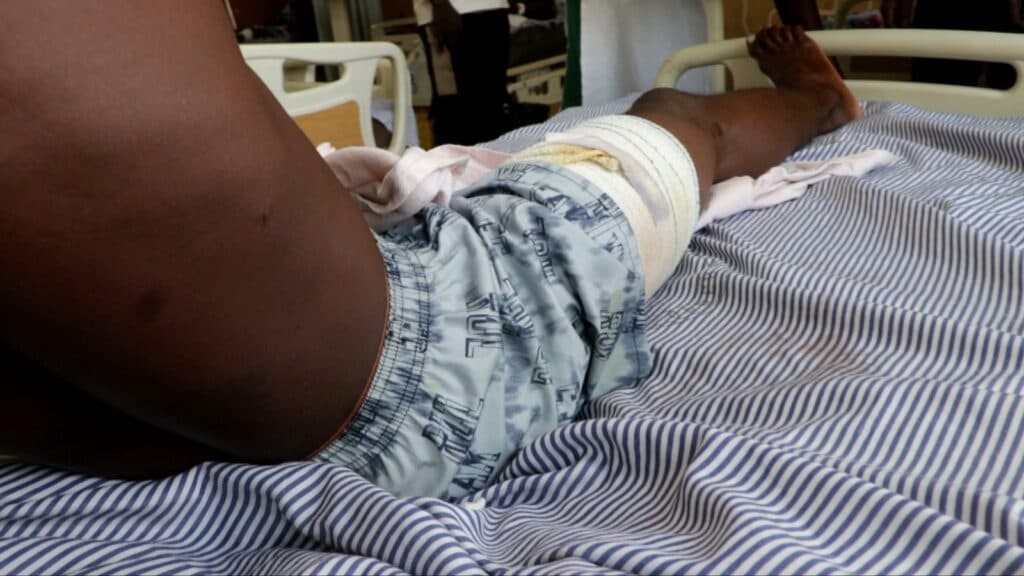 Stray bullet shatters bystander’s right leg in Wechiau clashes, MP demands swift justice