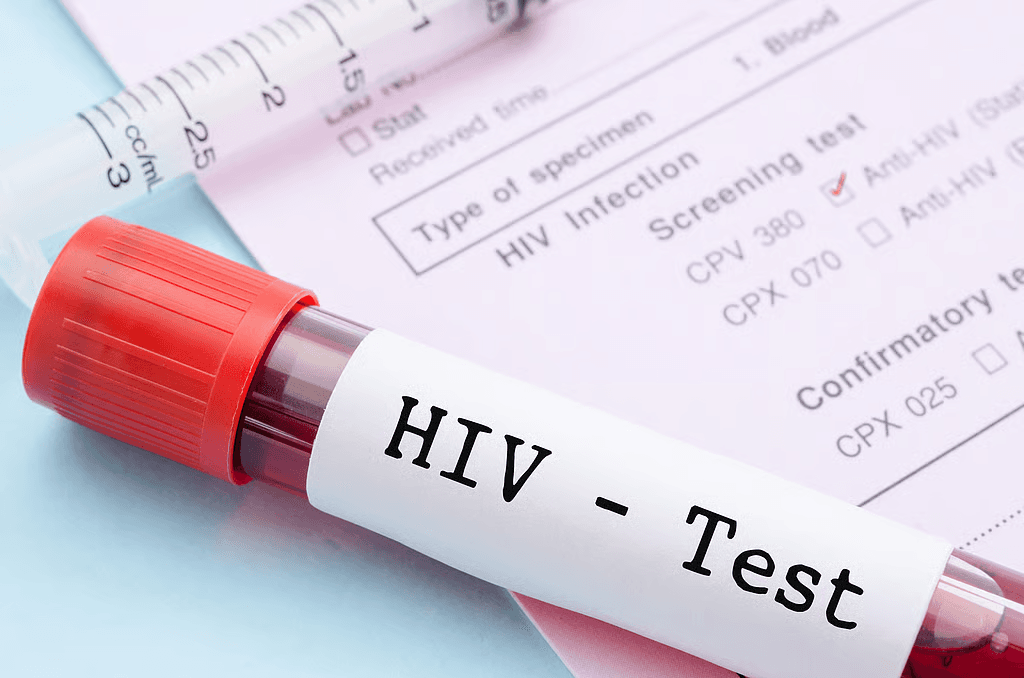 HIV stigma could derail Ghana’s 2030 target – AHF Ghana